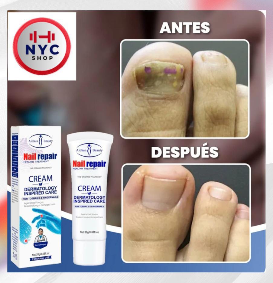 Crema Anti Hongos