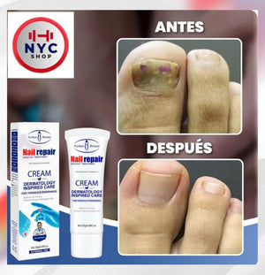 Crema Anti Hongos