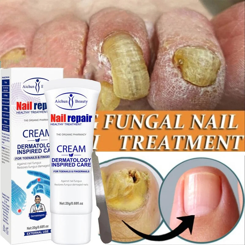 Crema Anti Hongos